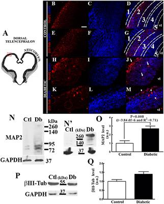 The Histamine H1 Receptor Participates in the Increased Dorsal Telencephalic Neurogenesis in Embryos from Diabetic Rats